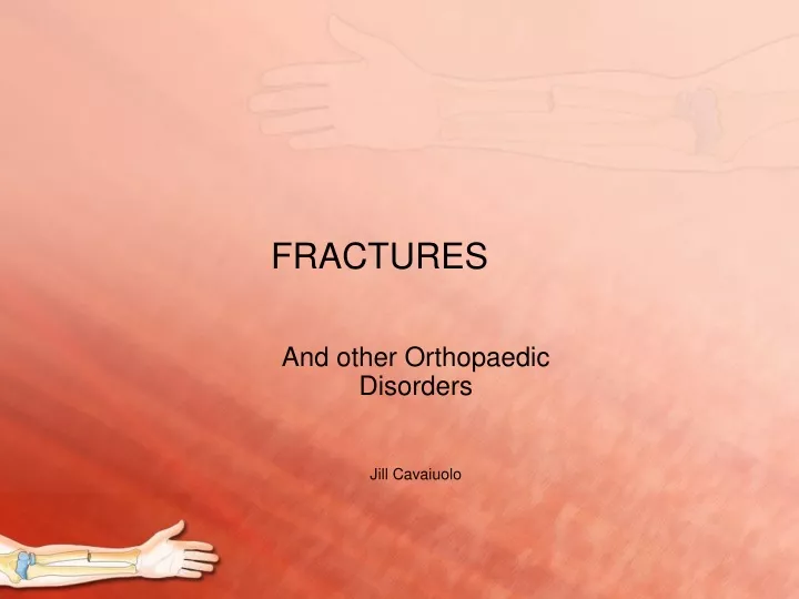 PPT - FRACTURES PowerPoint Presentation, Free Download - ID:9719153