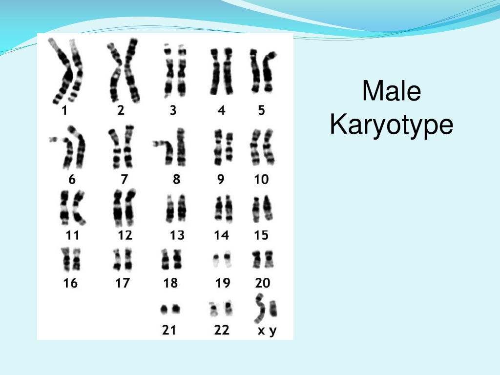 Ppt Karyotypes And Pedigrees Powerpoint Presentation Free Download