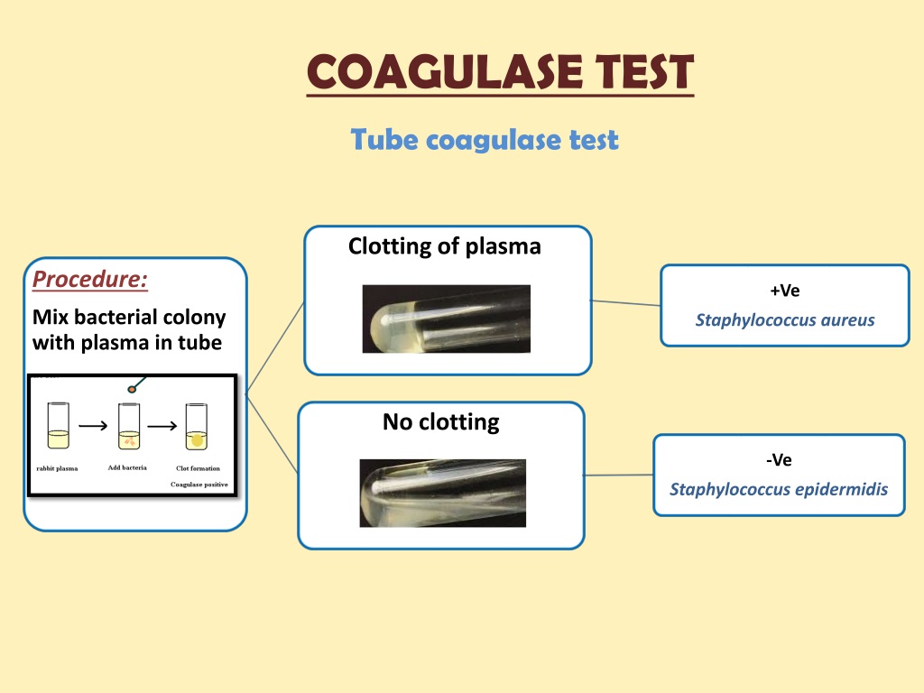 PPT - Practical of Urinary Tract Infection PowerPoint Presentation ...