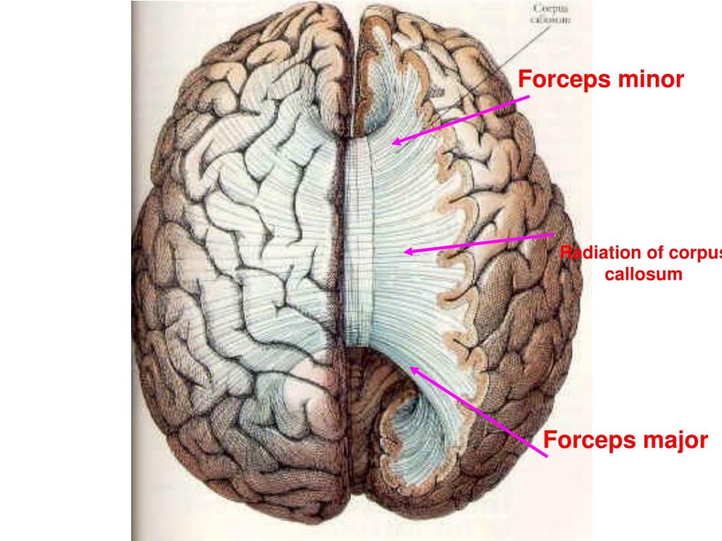 Теле велика. Мозолистое тело головного мозга. Мозолистое тело анатомия. Анатомия мозолистого тела головного мозга.