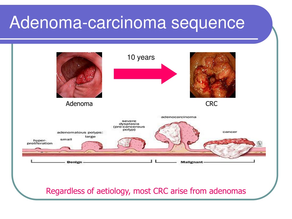 Qué significa carcinoma