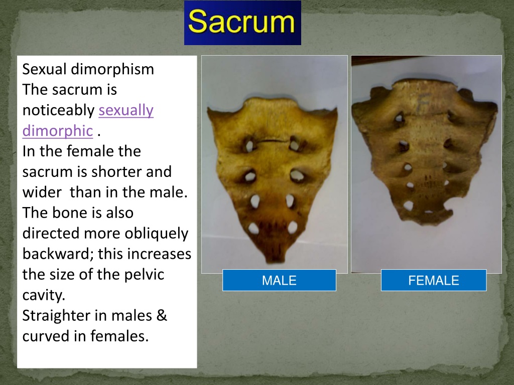 Ppt Sex Determination From Human Skeletal Remains { Skull Pelvis Sternum } Powerpoint