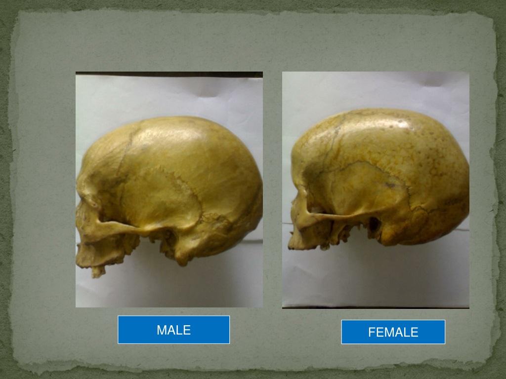 Ppt Sex Determination From Human Skeletal Remains Skull Pelvis Sternum Powerpoint 1144