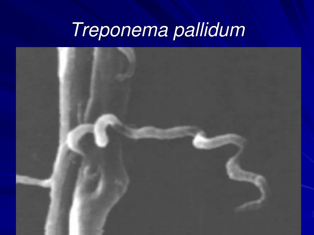 Treponema pallidum отрицательный. Treponema pallidum под микроскопом. Бледная трипонема спирохета или трепонема. Трепонема паллидум Тип дыхания. Бледная трепонема (Treponema pallidum).