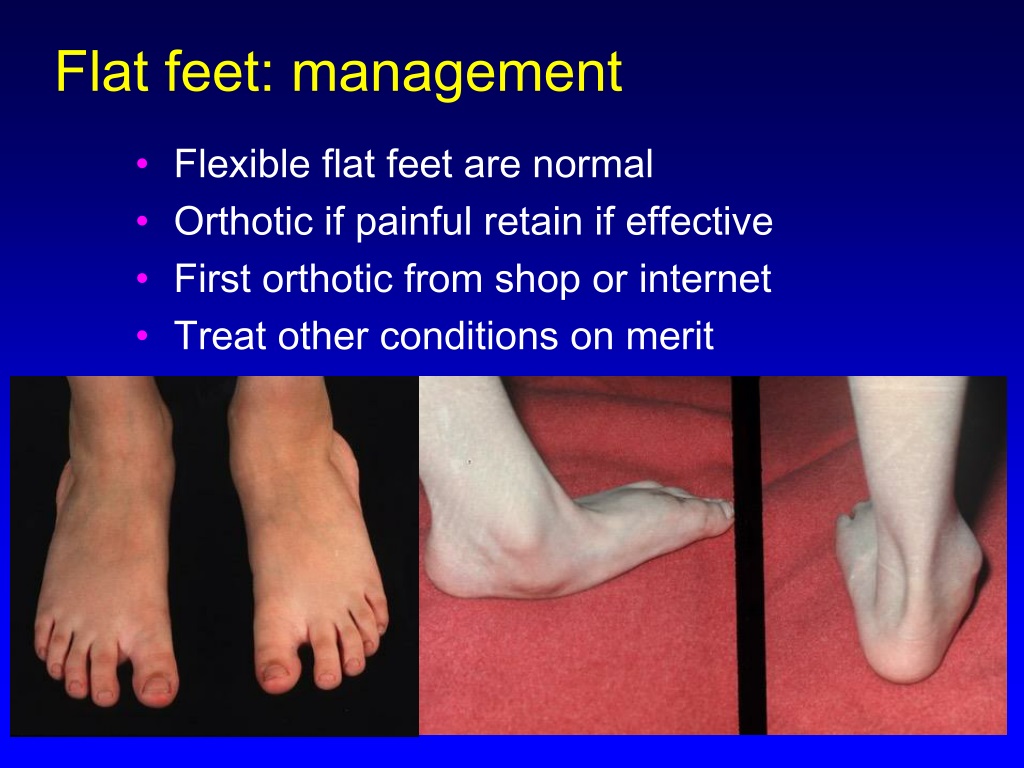 PPT - Normal and abnormal in Paediatric Orthopaedics; what should we do ...