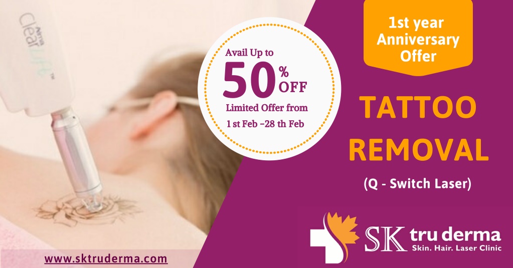PPT - Tattoo Removal Treatment in Sarjapur Road, Bangalore | SK truderma  anniversary Offer -2020 PowerPoint Presentation - ID:9778182